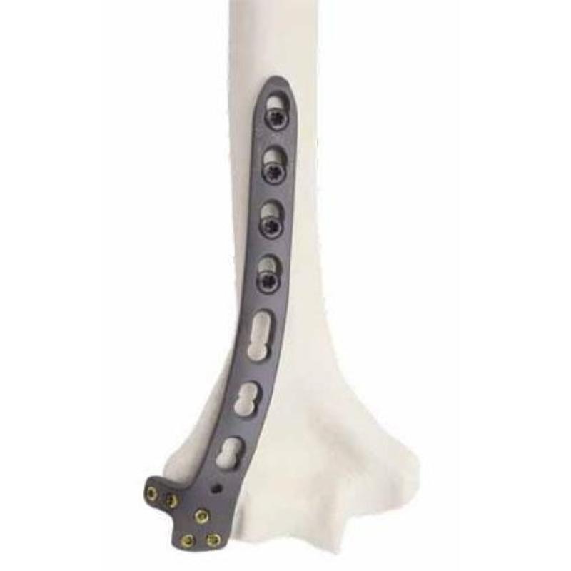 3.5 мм LCP Заднєбокова дистальна плечова -2, ліва WegoOrtho